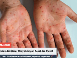 10 Cara Sembuh dari Cacar Monyet dengan Cepat dan Efektif